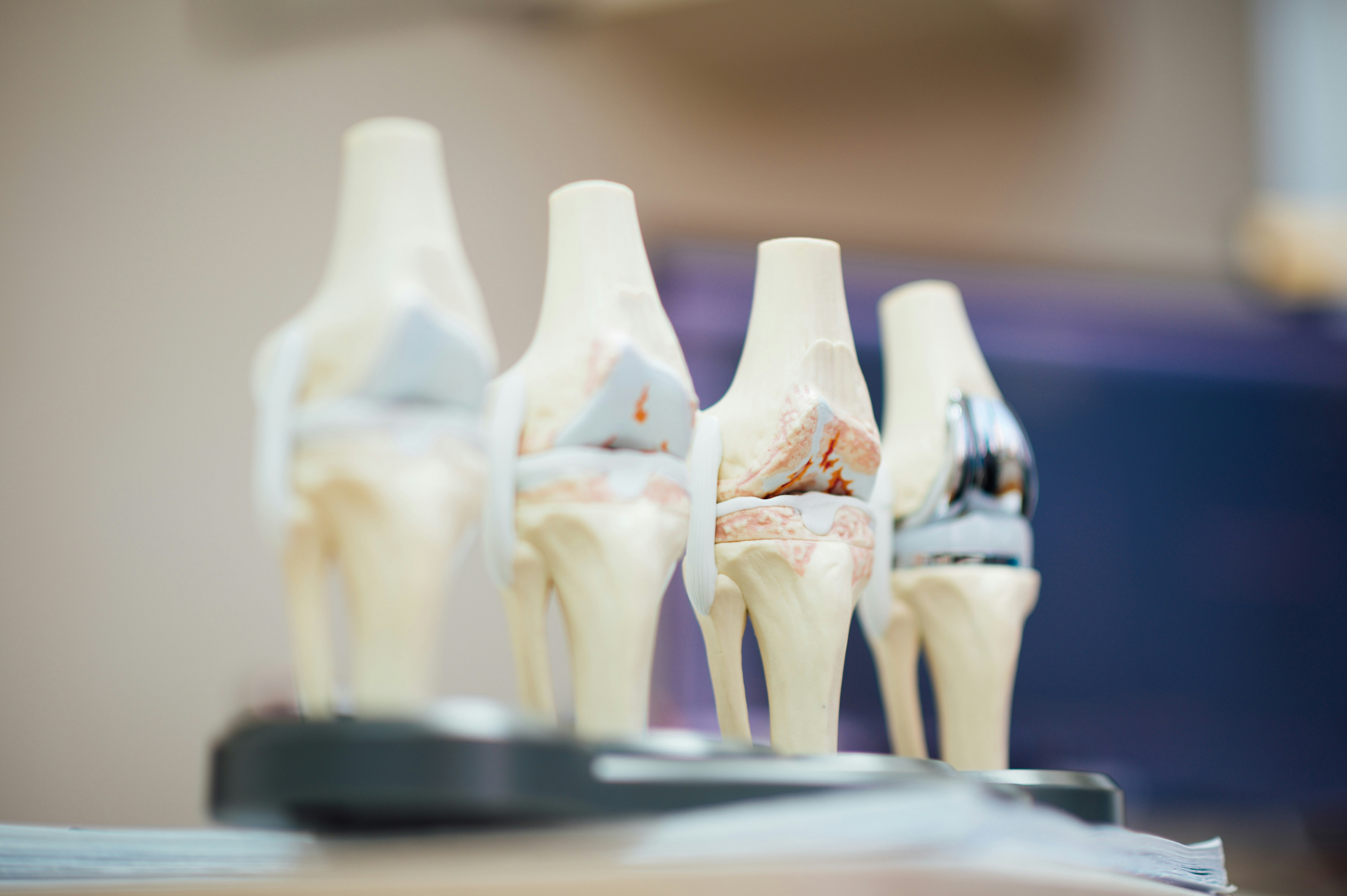 Orthopedics & Joints